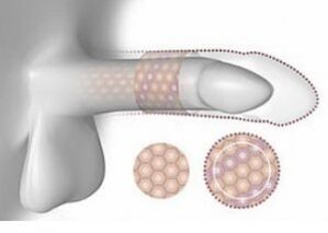 The adult penis in volume